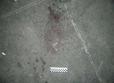 В центре Киева 19-летний парень получил удар ножом в живот (ФОТО)