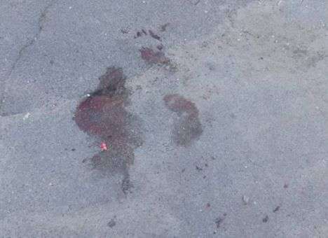 В полиции рассказали об убийстве на Левом берегу в Киеве