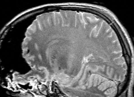 Подробности смерти Каримова: В операции уже не было смысла