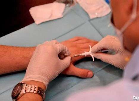 В Украине появился первый человек с компьютерным чипом под кожей (ФОТО)