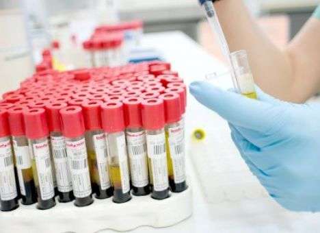 Специалисты назвали 7 анализов, которые нужно сделать, если не удается похудеть