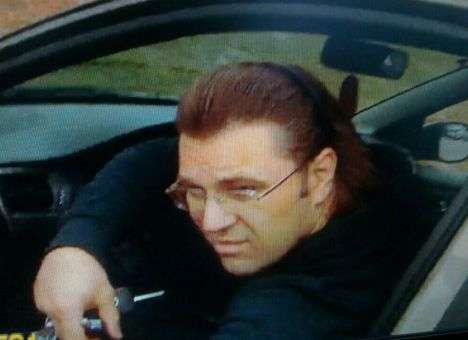 В больнице им. Мечникова рассказали, откуда у Пугачева огромный шрам