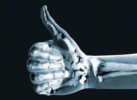 Медики создали искусственную кость с новыми «спецэффектами»