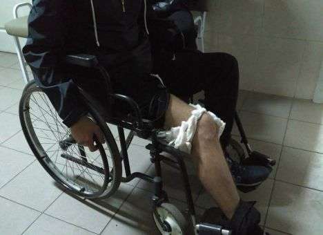 Стало известно о ранениях копов, пострадавших в драке со стрельбой в Николаеве (ФОТО)