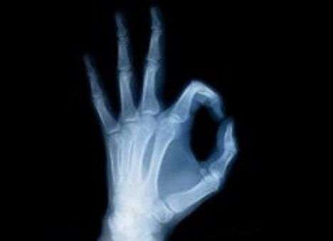 Секрет крепких и здоровых костей раскрыли специалисты