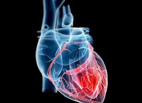 Специалисты сделали прорыв в лечении сердечной недостаточности