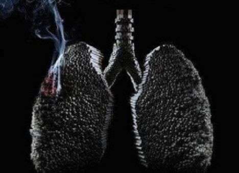 Специалисты  выяснили, как диагностировать рак легких у некурящих