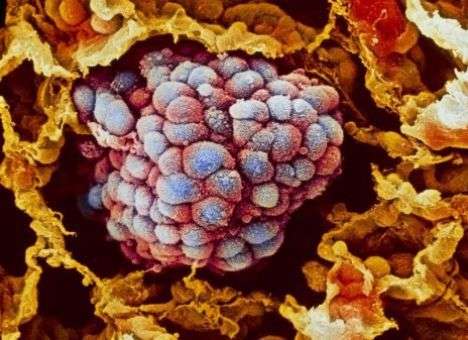 Эксперты нашли альтернативный способ лечения рака