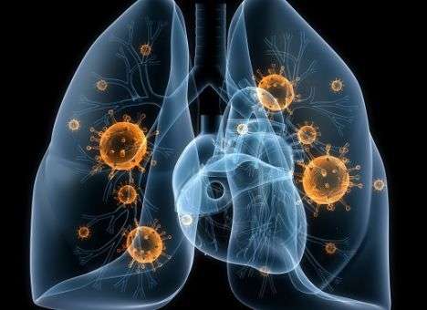 Найден новый способ борьбы с туберкулезом