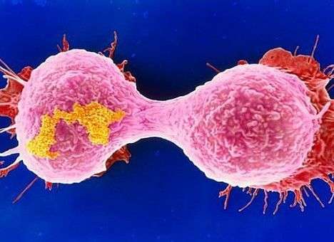 Названа главная причина появления раковых опухолей