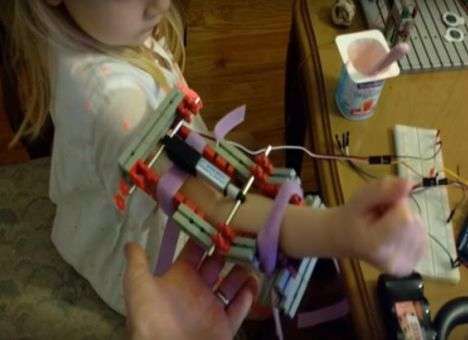 Программист напечатал на 3D-принтере бионический ортез (ВИДЕО)