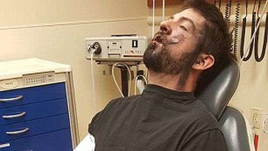 У американца во рту взорвалась электронная сигарета (фото)