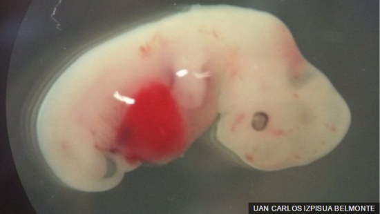 Ученым удалось скрестить свинью и человека