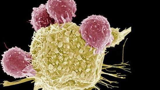 Найден инновационный метод борьбы с раком