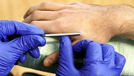 В Бельгии людям вшили под кожу электронные ключи