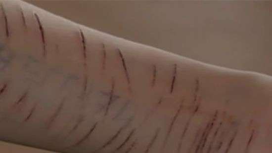 Казахский школьник изрезал руку, чтобы вступить в «группу смерти»