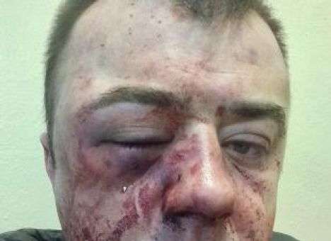 В Днепре жестоко избили известного адвоката