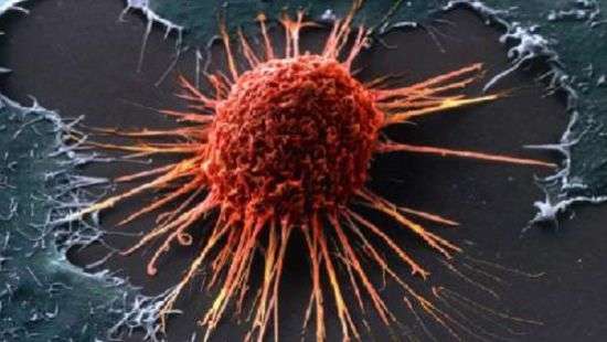 Врачи назвали неожиданные причины онкологических заболеваний