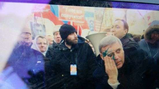 Российского оппозиционера облили зеленкой