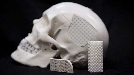 Костные имплантаты теперь будут делать из полиэтилена – ученые