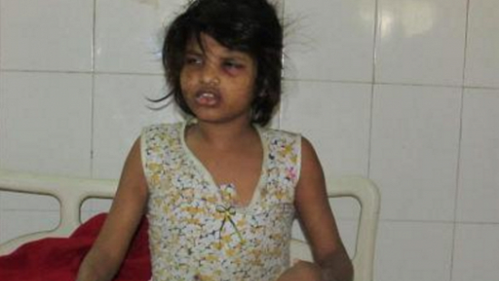 В Индии нашли девочку, жившую в джунглях с обезьянами