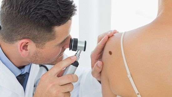 Врачи назвали главные признаки меланомы