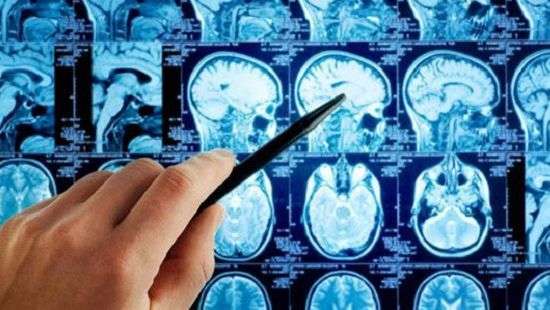 Медики нашли самое эффективное лечение рака мозга