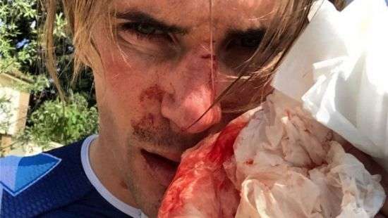 Французского велогонщика избили на тренировке