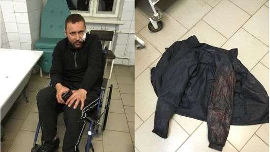 Заезжие наемники рейдеров из АХ «Мрия» избили участника АТО на Тернопольщине