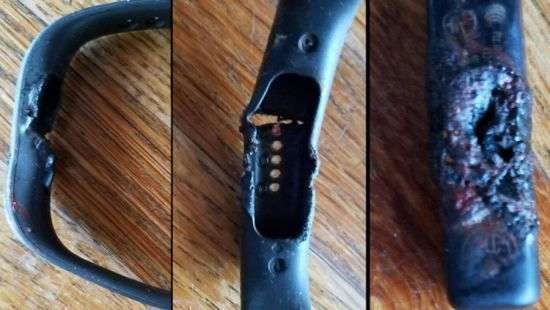 Браслет Fitbit чуть не сжег свою владелицу