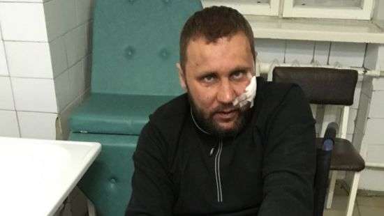 Пострадавший в драке участник АТО Александр Починок оказался ее зачинщиком