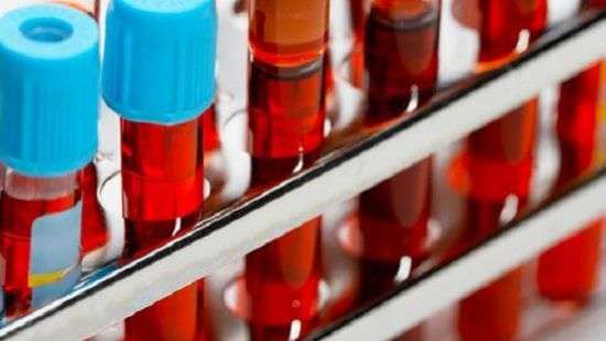 Как группа крови влияет на вероятность инфаркта, рассказали специалисты