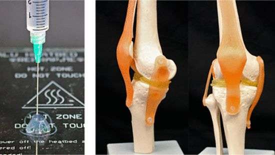 Новый материал позволяет печатать коленные хрящи-импланты на 3D-принтере
