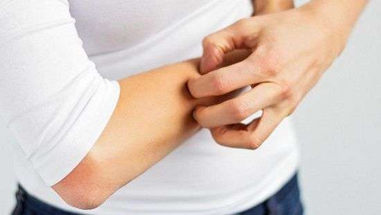 Медики назвали ключевую причину экземы