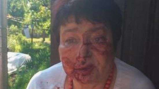 Друг депутата Даниша задержал «титушку», который напал на председателя ТИК Коцюбинского