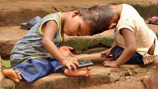 В Индии решили разделить близнецов, которые срослись головами (фото)