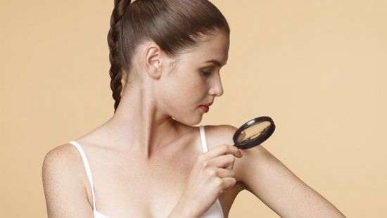 Как отличить родинку от рака, рассказали специалисты