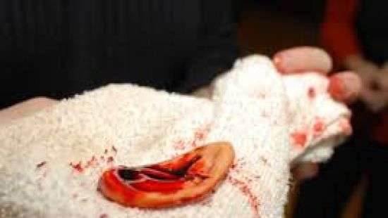 В России депутату отгрызли ухо за отказ выпить