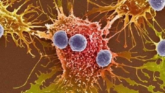 Врачи назвали фактор повышающий риск рака