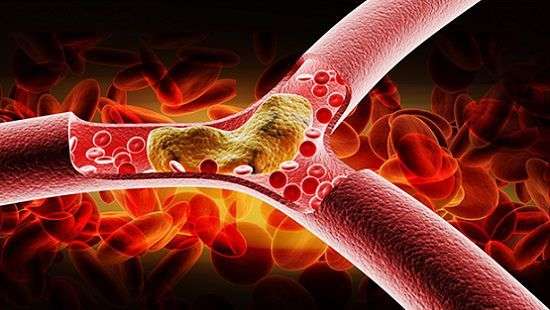 Ученые создали уникальное лекарство от тромбов