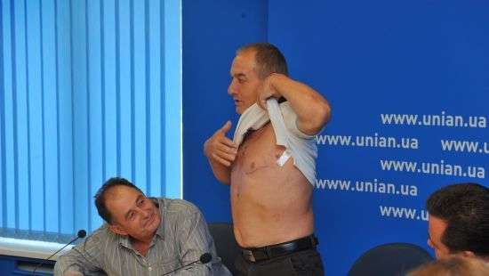 Ишемическая болезнь сердца - украинские кардиохирурги внедрили новый, более щадящий метод операции на сердце при ИБС