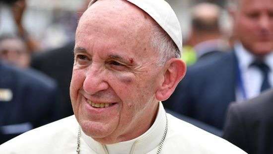 Папа Римский получил травму во время поездки на авто (ВИДЕО)
