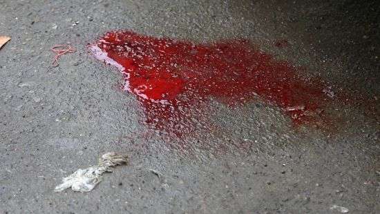 Одному из освобожденных по «делу 2 мая» проломили голову