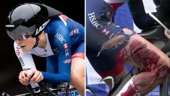 Британская велосипедистка получила ужаснейшую травму