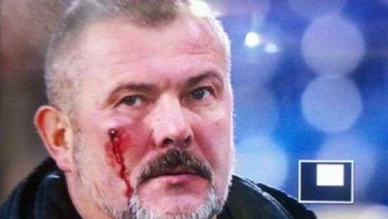 Футбольные ультрас избили народного депутата - ВИДЕО