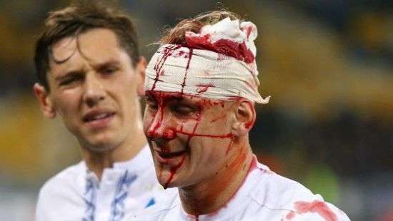 Вида не сыграет в матче против «Шахтера»