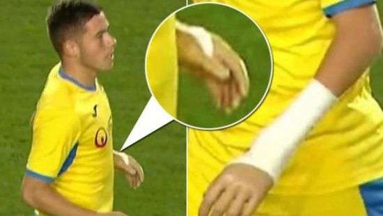 Футболист без руки дебютировал в проффутболе