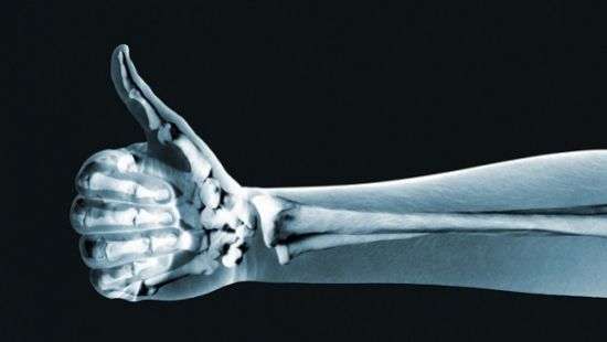 Медики нашли новый способ лечения переломов