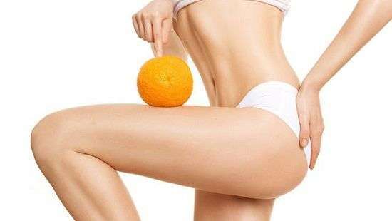 Эксперты назвали лучшие способы, как избавиться от целлюлита