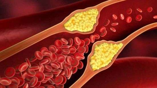 Составлен список продуктов, которые очистят артерии и защитят от сердечного приступа